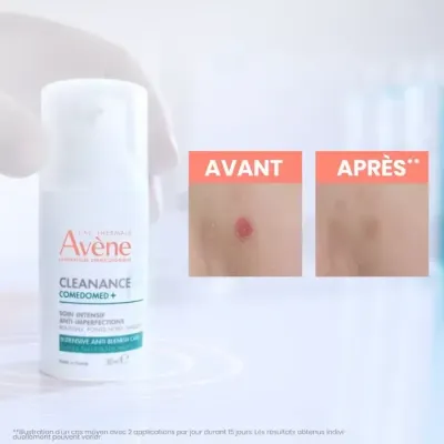 AVENE CLEANANCE COMEDOMED CONCENTRE ANTI IMPERFECTION 30ML