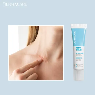 DERMACARE KELO TREAT 15ML