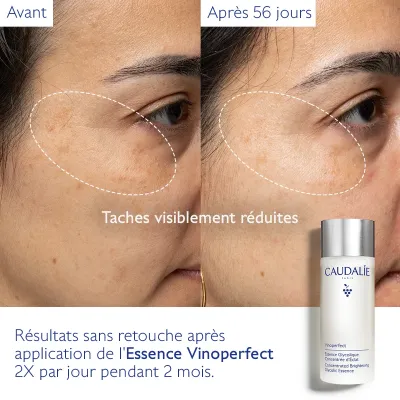 CAUDALIE VINOPERFECT ESSENCE GLYCOLIQUE CONCENTREE D’ECLAT 100ML